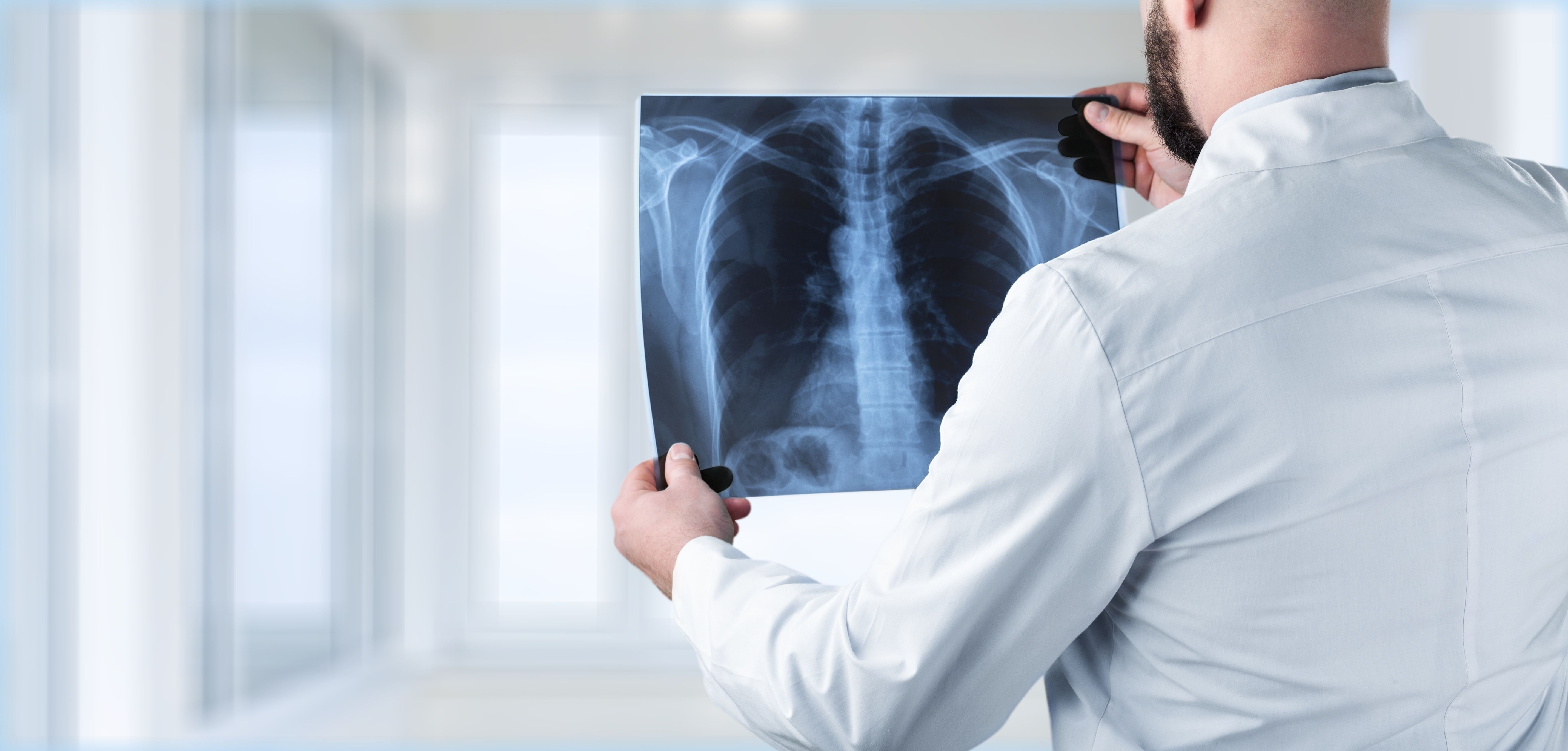 Avaliação Propedêutica do Nódulo Pulmonar: Guia Completo
