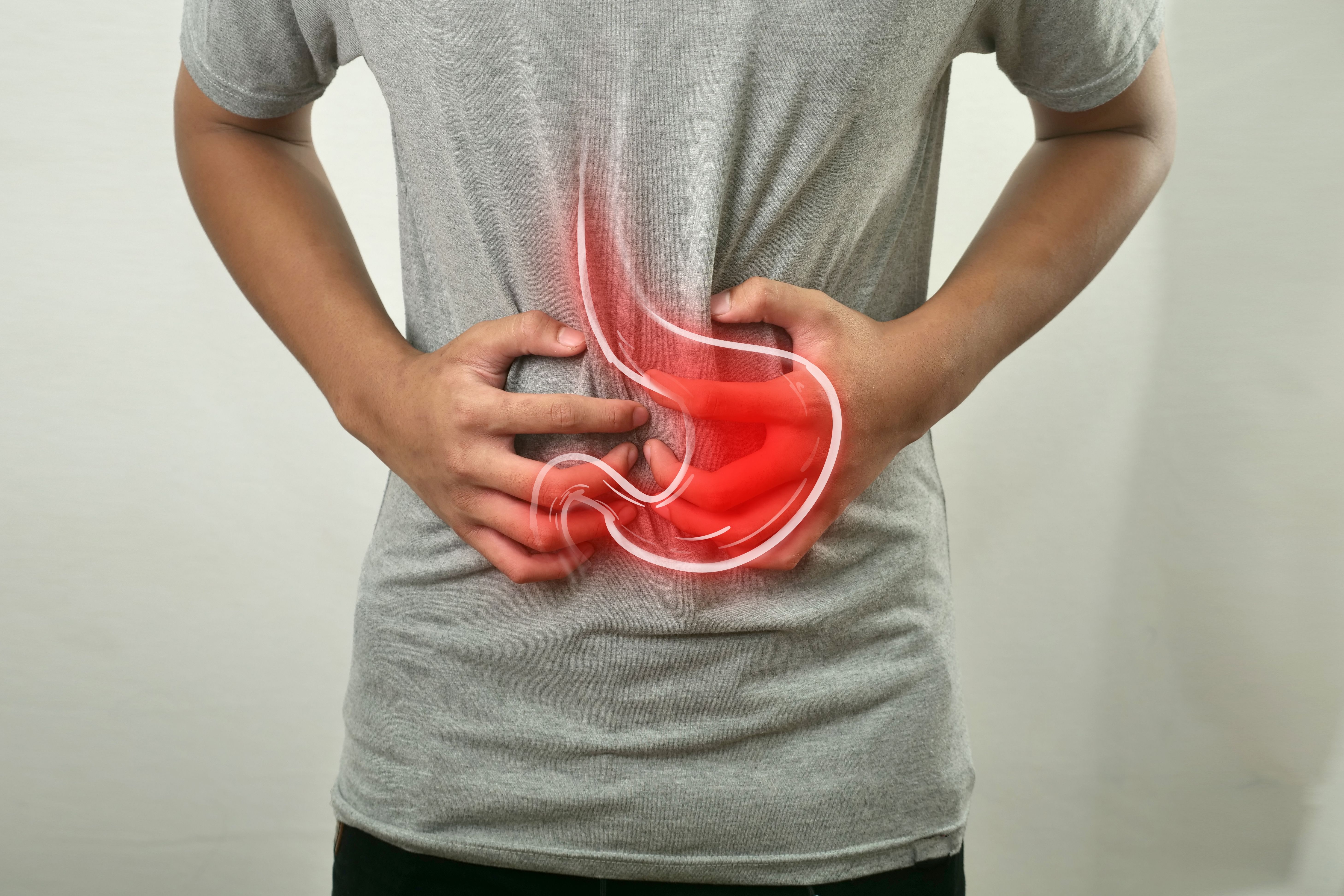 Câncer gástrico: como diagnosticar e tratar