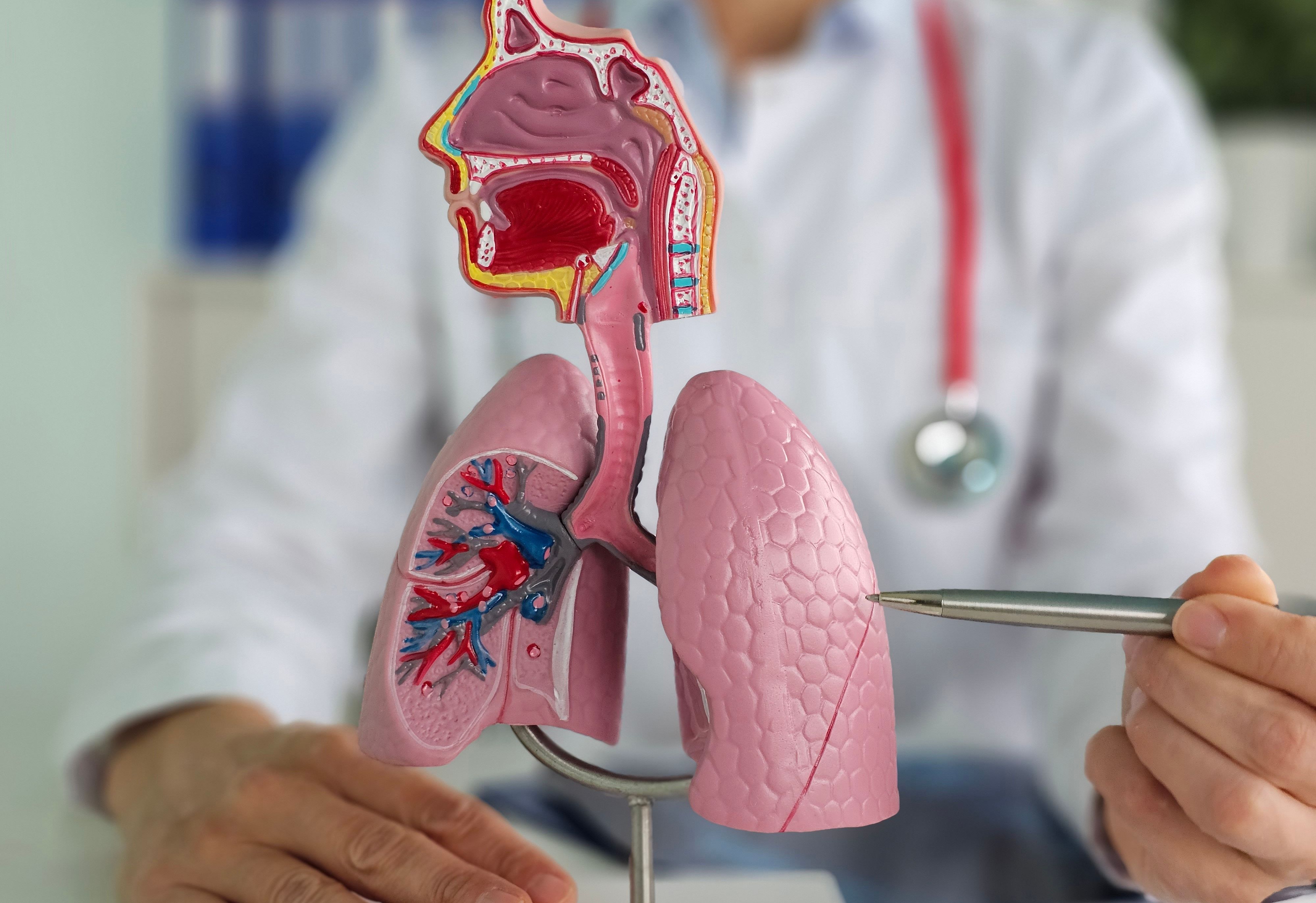 Doença pulmonar obstrutiva crônica (DPOC): diagnóstico, tratamento e manejo das exacerbações