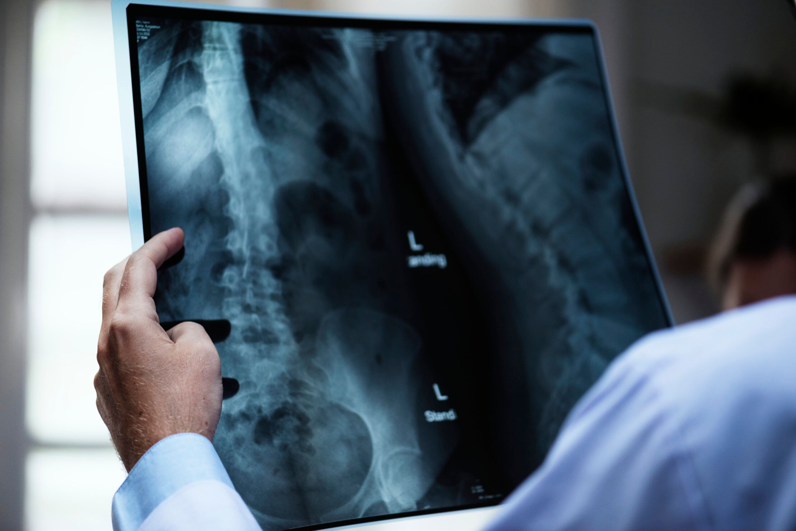 Qual o salário de um radiologista? Formação, requisitos e mais!