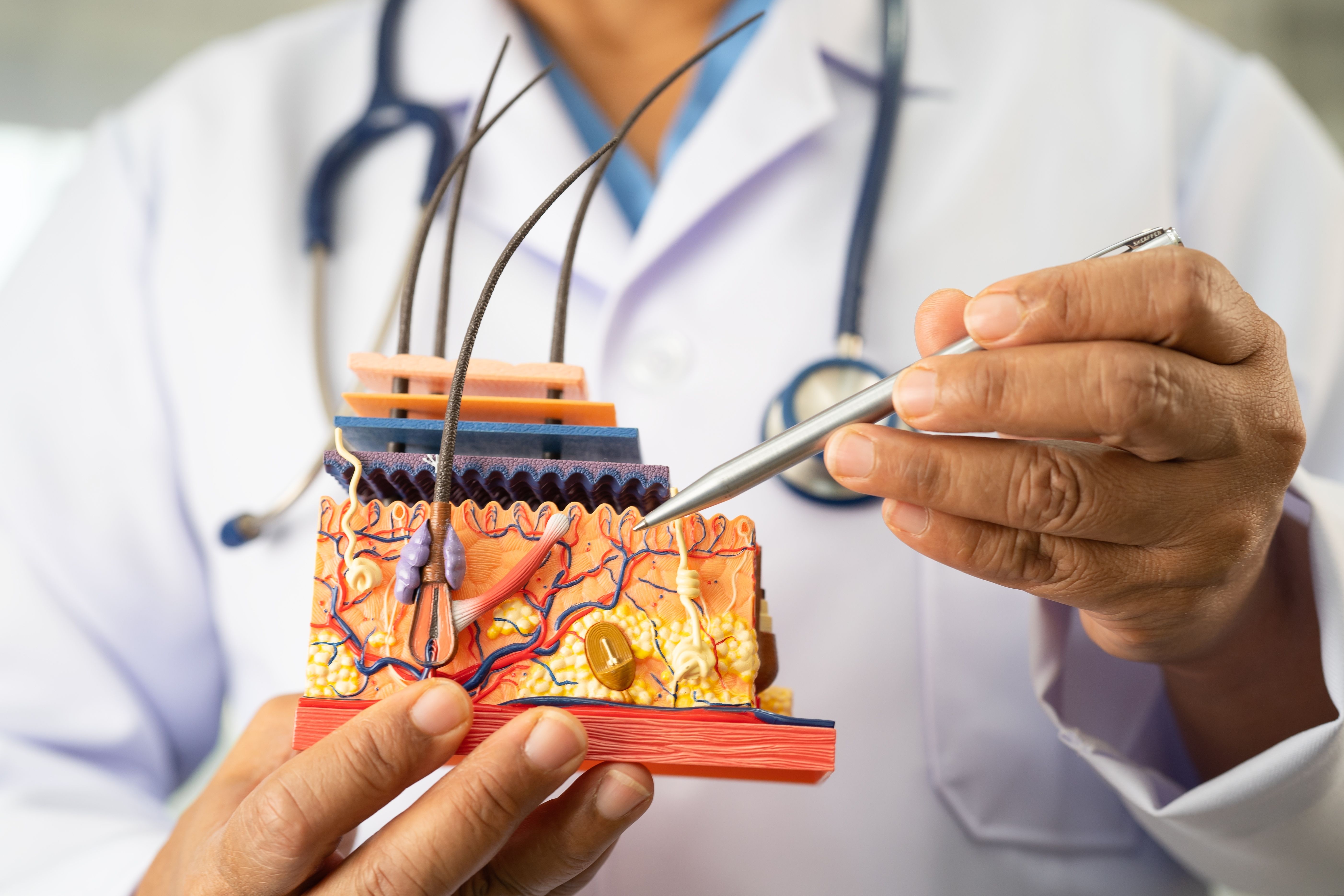 Transplante Capilar: como a Cirurgia Plástica atua na restauração capilar e na autoestima dos pacientes